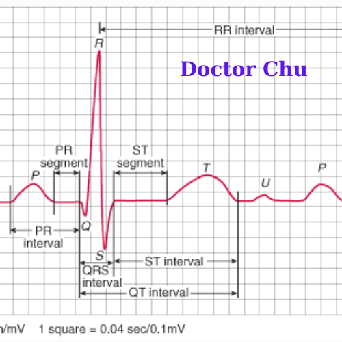 Khoảng PQ là gì? Ý nghĩa khoảng PQ khi đọc điện tâm đồ